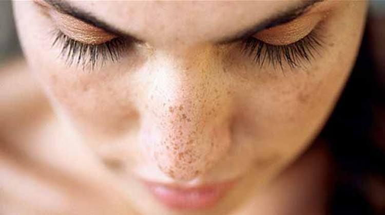 Lekeler İçin Maske Tarifi Lekeler İçin Maske Tarifi