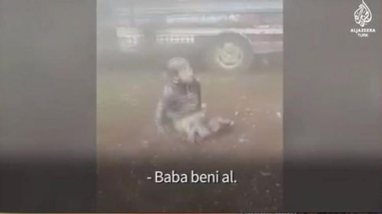 Esed rejiminin saldırılarında bacaklarını kaybetti
