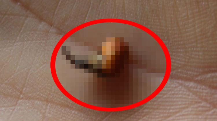 13 yaşındaki kızın kulağından çıkan şey şoke etti