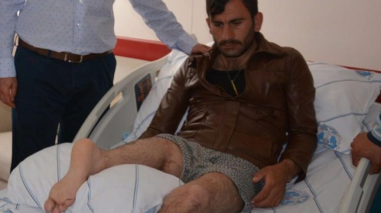 Bacağını ters diktiler Sebebi ise Bacağını ters diktiler Sebebi ise