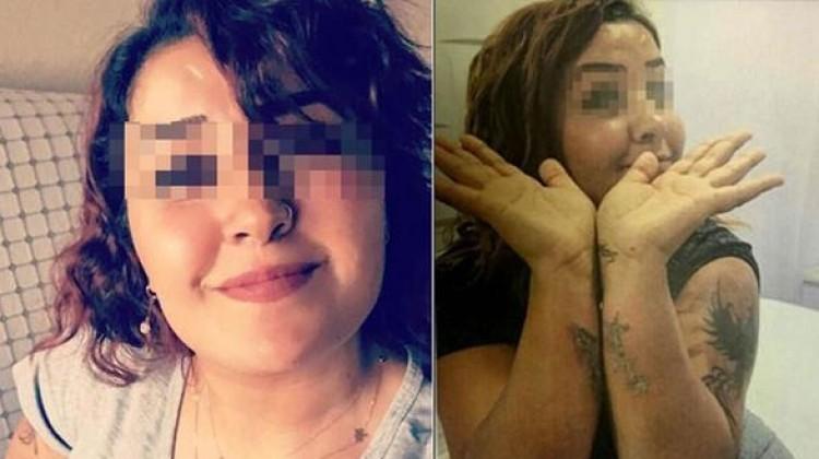 Dövme sildirmek isterken hayatının şokunu yaşadı 64