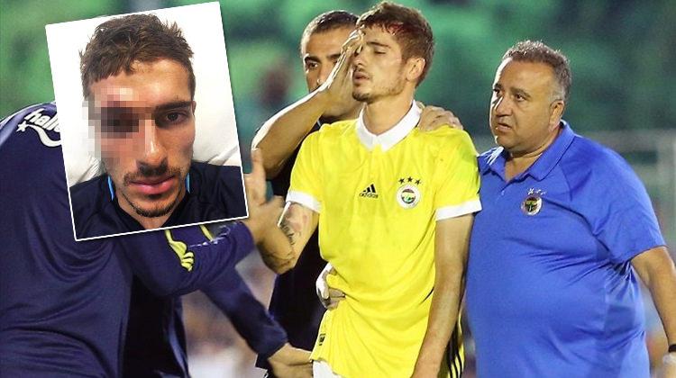 Neustadter bu hale geldi! 10 dikiş