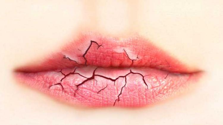 Dudaklarda herpes tedavisi: hekimler tavsiye Dudaklarda herpes tedavisi: hekimler tavsiye