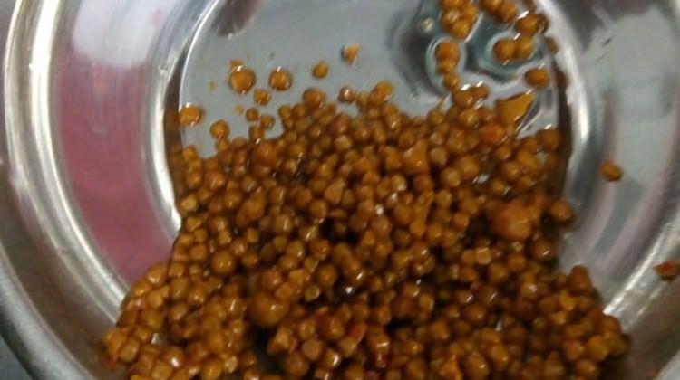 Doktorlar gözüne inanamadı... Safra kesesinden...