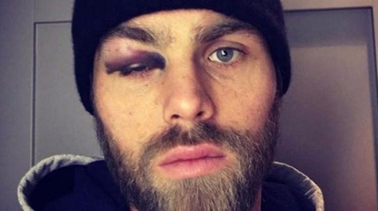 Johan Elmander tanınmaz hale geldi!