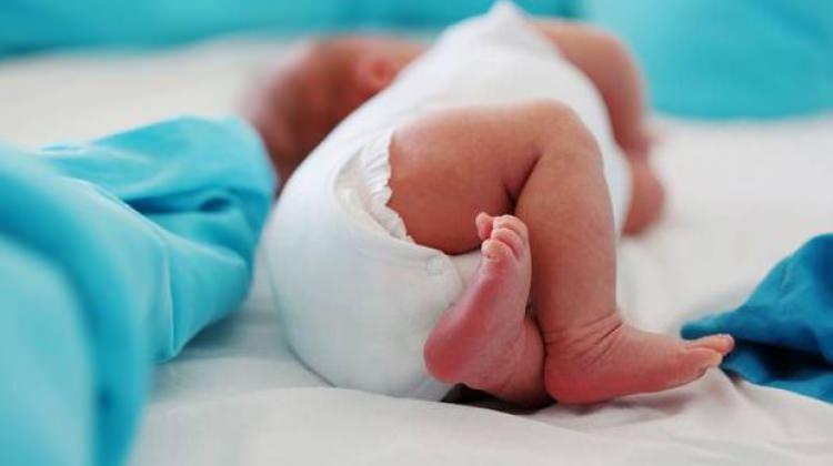 Bebeklere kalça ultrasonu çektirilmeli mi Bebeklere kalça ultrasonu çektirilmeli mi