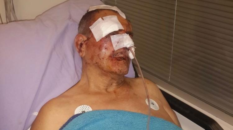 Komşusundan aidat istedi hastanelik oldu