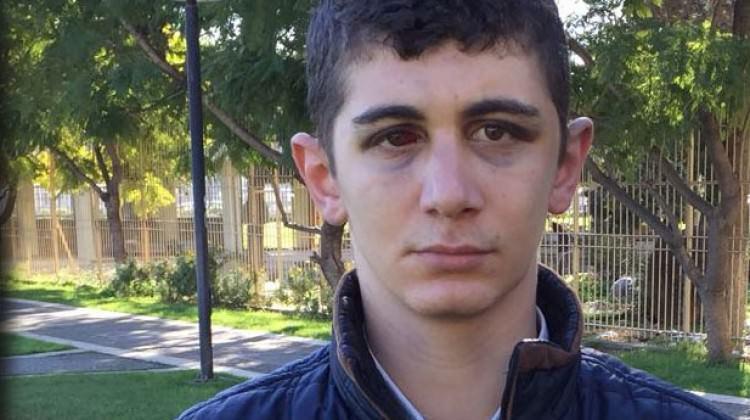 Engelli genci dövmüştü! Cezası belli oldu