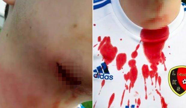 Futbol terörü! Boğazını bıçakla kesti!