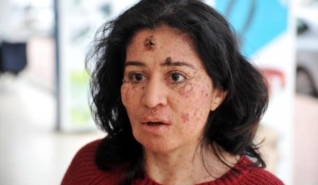 Güneşin erittiği kadın! Büyük dram...