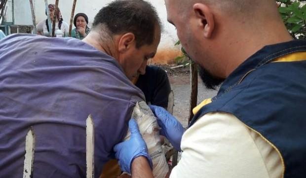 Feci olay! Ağaçtan düşünce koluna saplandı