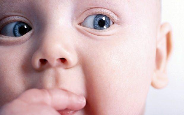 Bebeklerde Goz Kaymasi Neden Olur Bebek Haberleri