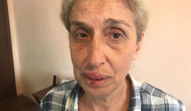 Sokak hayvanlarını beslerken saldırıya uğradı