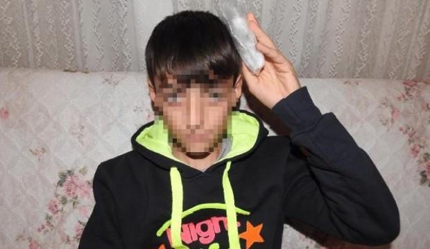 Ortaokulda skandal iddia! Zaten ameliyatlıydı…