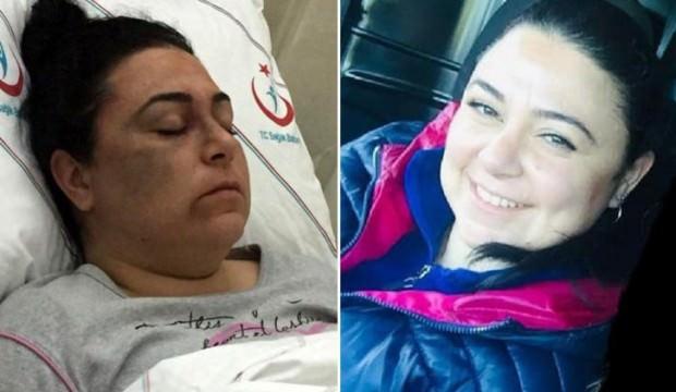 Akılalmaz olay! 3 kadını döverek hastanelik etti