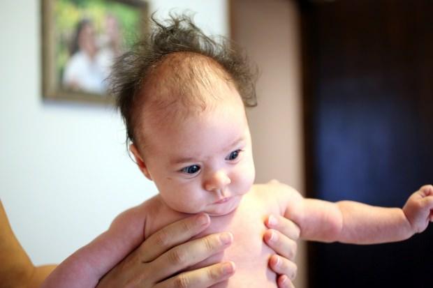 bebeklerde saç gürleştirme