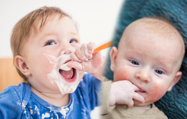 bebeklerde besin alerjisi belirtileri
