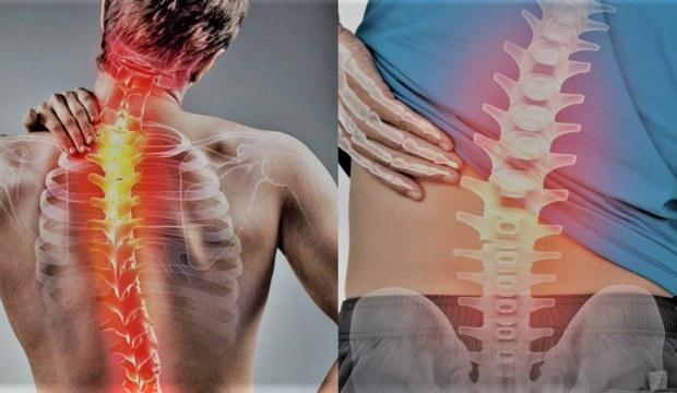 Skolyoz (Omurga Eğriliği) nedir? Skolyoz belirtileri çeşitleri tedavisi