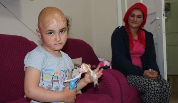 Yürek burkan olay! Minik Zeynep'in tek hayali 'peruk'