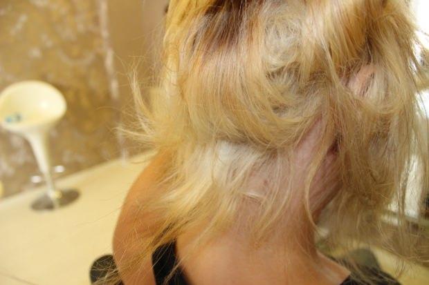 saç yanmasına özel bakım önerileri
