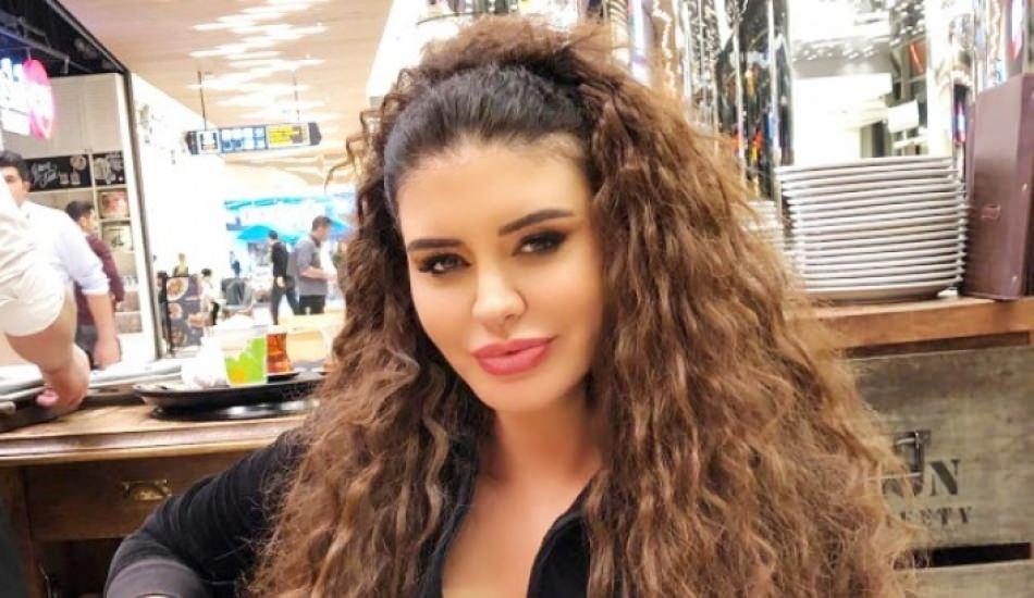 ebru_polat_talihsiz_bir_kaza_yasadi_yine_de_devam_dedi_1565678938_7548.jpg