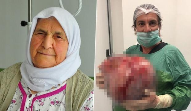 Kilo aldığını sandı, karnından öyle bir şey çıktı ki!
