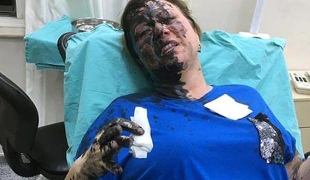 Dövüp, siyah renkli sıvı döktüler! Ne olduğu araştırılıyor