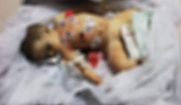 PYD/YPG'li teröristlerin alçak saldırısı sonucunda şehit düşen 9 aylık bebek Muhammed Omar'ın görüntüsü