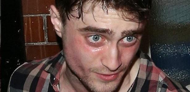 Ünlü Dan Radcliffe, bir oyuncunun hayatı hakkında Ünlü Dan Radcliffe, bir oyuncunun hayatı hakkında
