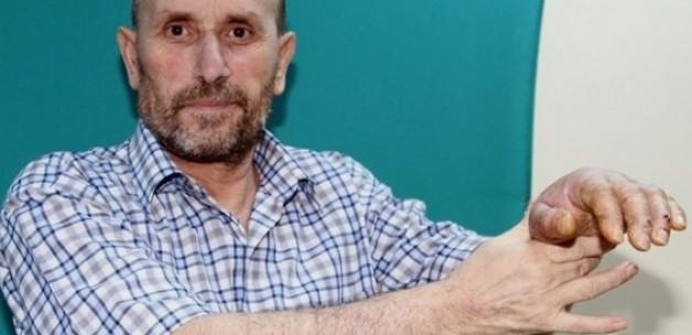Kopan kolunu hastaneye götürdü