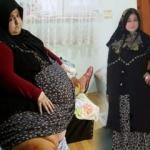 Yıllarca oturarak uyudu...İnanılmaz değişim!