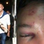 İngiliz futbolcuyu bu hale getirdiler!