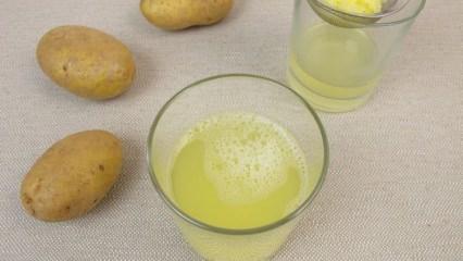 Kaz yağı ne işe yarar ve faydaları var mıdır Kaz yağı ne işe yarar ve faydaları var mıdır