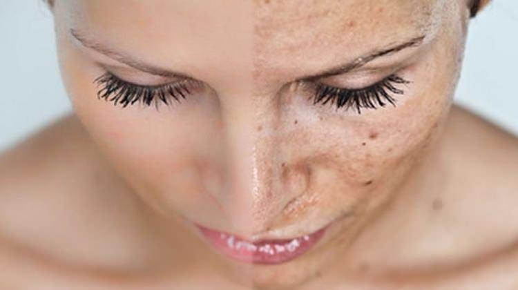 Candice Swanepoel’den cildi nemlendiren maske tarifi 81