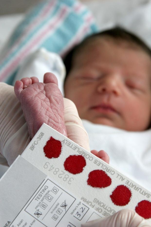 Bebeklerde topuk kanı neden alınır? Bebeklerde topuk kanı testi ile ilgili gerekenler