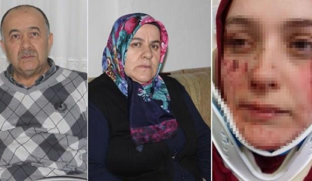 Koca dehşeti! Bardakla yüzünü bu hale getirdi