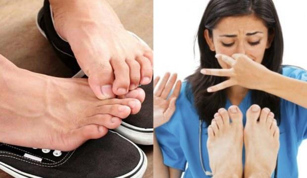 Ayak kokusu nasıl geçer? Ayak kokusuna kesin, etkili ve doğal çözüm...