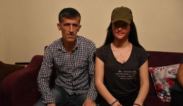 Berfin'in yüzünü asitle yakan saldırgan hakkında flaş gelişme