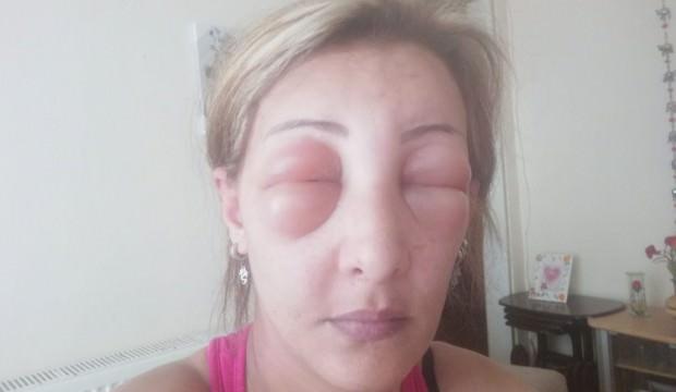 Saçlarını yaptırmak için kuaföre gitti, canından oluyordu