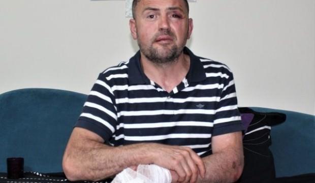 Terör gazisine demir çubukla saldırı!
