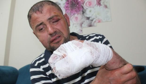 Yüzde 92 engelli gaziyi ayağını uzattı diye öldüresiye dövdüler