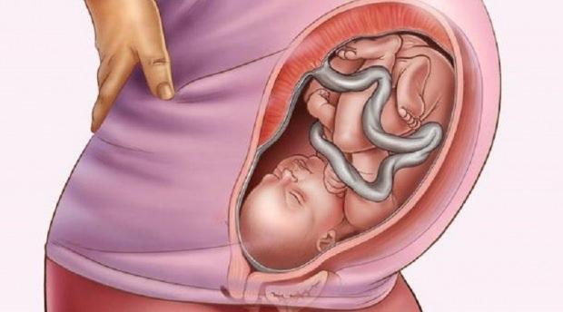 Hamilelikte plasenta kanaması! Plasenta kanaması neden olur?