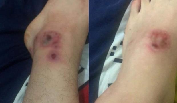 Sivrisinekler bu hale getirdi! Evinden dahi çıkamıyor