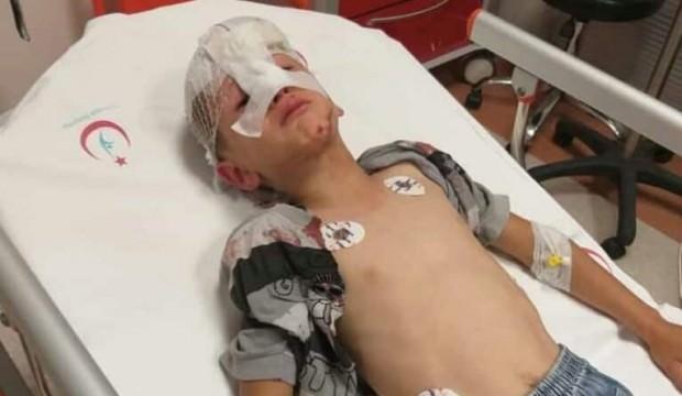 Korkunç olay! Küçük çocuk bir anda kanlar içinde yere yığıldı