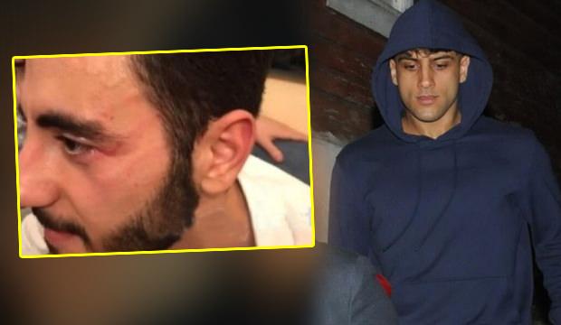 Reynmen muhabire saldırdı: Yusuf Aktaş çirkin saldırı sonrası karakolluk oldu