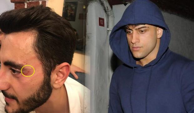 Yusuf Aktaş muhabiri dövdü! YouTuber Reynmen gözaltına alındı
