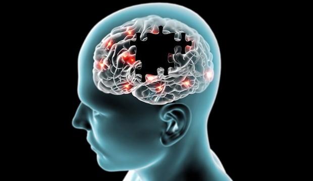 Alzheimer hastalığı ilk belirtilerden 20 yıl önce başlıyor