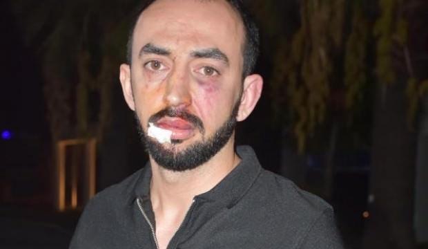 İyilik yapmak isterken canından oluyordu