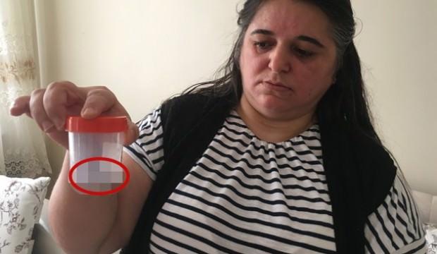 Karın ağrısı ile gitti, midesinden çıkan şoke etti!