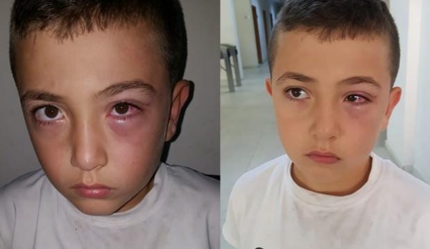 Akılalmaz olay! Oğluyla tartıştı diye bu hale getirdi